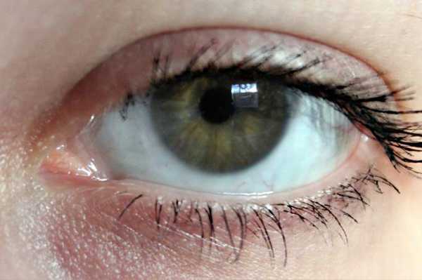 आंखों में विविध रोग का 11 घरेलु उपचार - 11 Homemade Remedies for Miscellaneous Diseases of the Eye