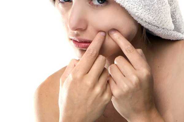 फोड़े-फुंसी का 26 घरेलु उपचार - 26 Homemade Remedies for Abscesses - Pimple